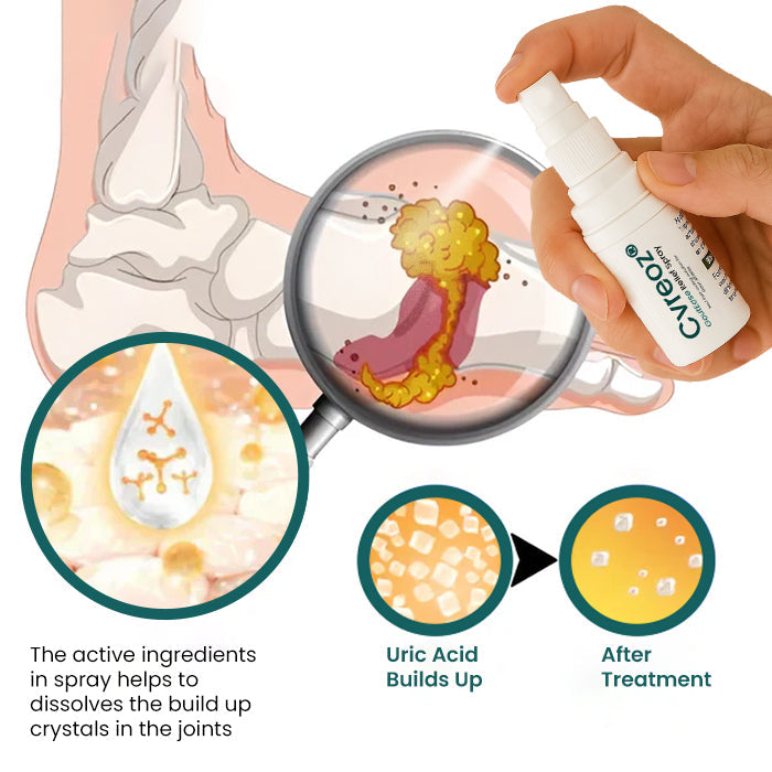 Only 10 pieces left đCvreozÂŽ GoutEase Relief Spray