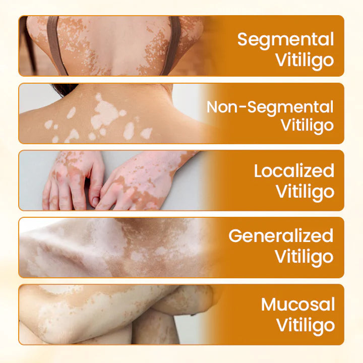 Cvreoz® VitiClear Pro Bee Venom Cream