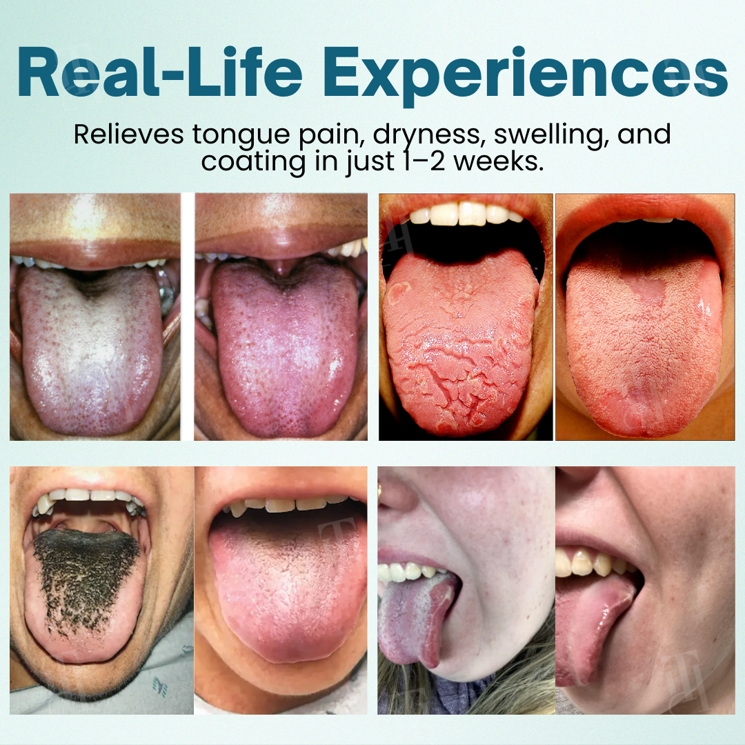 Piguiayยฎ ProShield Tongue Restore Sprayโ
๐๐ซ๐จ๐ฏ๐ข๐๐๐ฌ ๐ซ๐๐ฅ๐ข๐๐ ๐ข๐ง ๐ฃ๐ฎ๐ฌ๐ญ ๐ ๐ฆ๐ข๐ง๐ฎ๐ญ๐๐ฌ