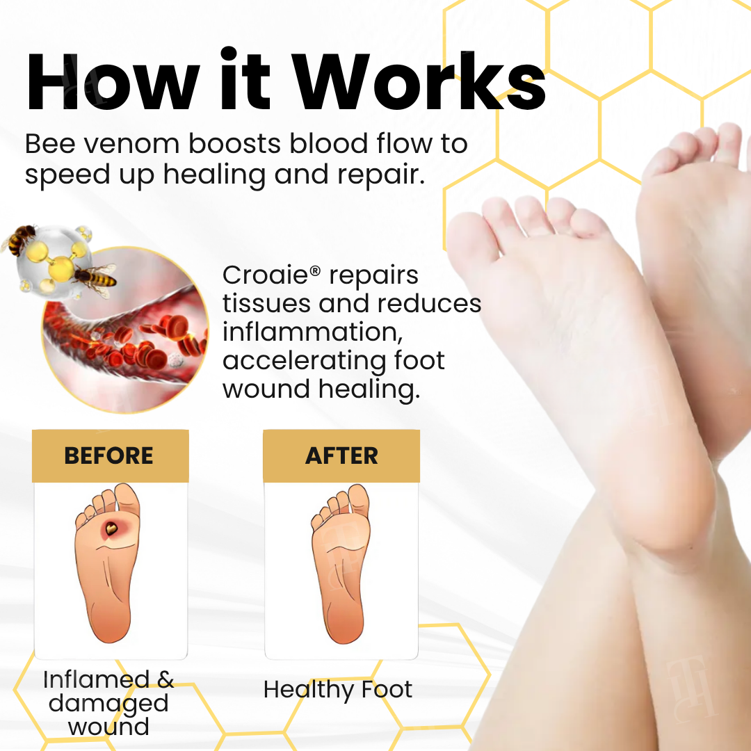 Croaieยฎ Bee Venom Diabetic Foot Ulcer Spray โ
๐๐ข๐ฌ๐ข๐๐ฅ๐ ๐ข๐ฆ๐ฉ๐ซ๐จ๐ฏ๐๐ฆ๐๐ง๐ญ ๐ข๐ง ๐-๐ ๐ฐ๐๐๐ค๐ฌโ