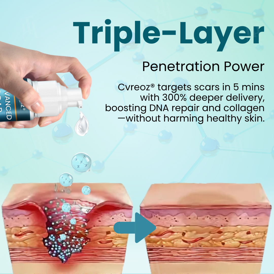 đ«Exclusive Patented Formulađ«CvreozÂź Advanced Scar Gel