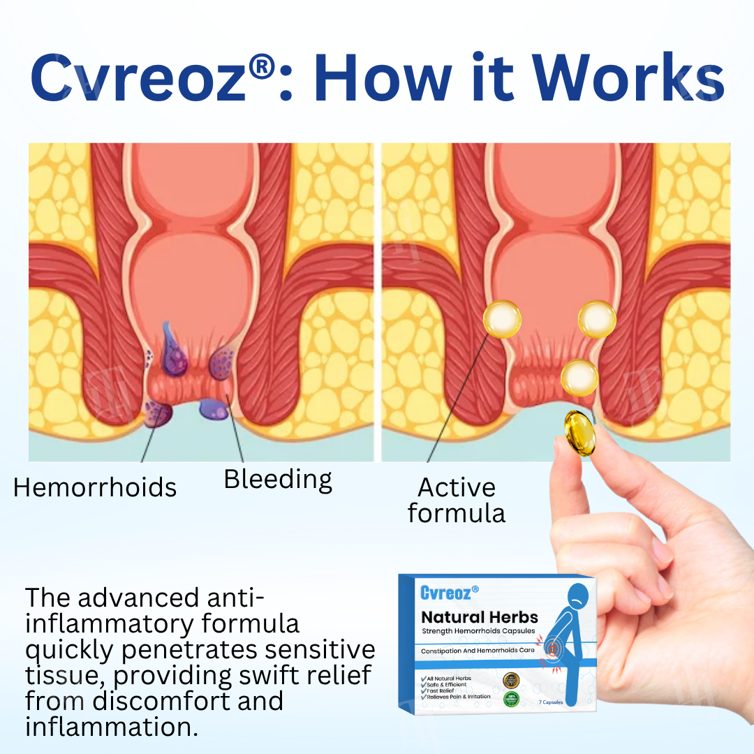 Cvreoz® Natural Herbs Strength Hemorrhoids Capsules✨EFFECTIVE WITHIN 5–7 DAYS! 🚀