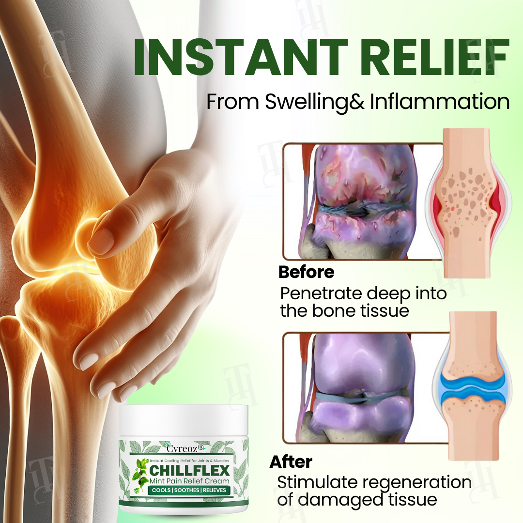 Only 10 pieces left 🚀Cvreoz® Chillflex Mint Pain Relief Cream