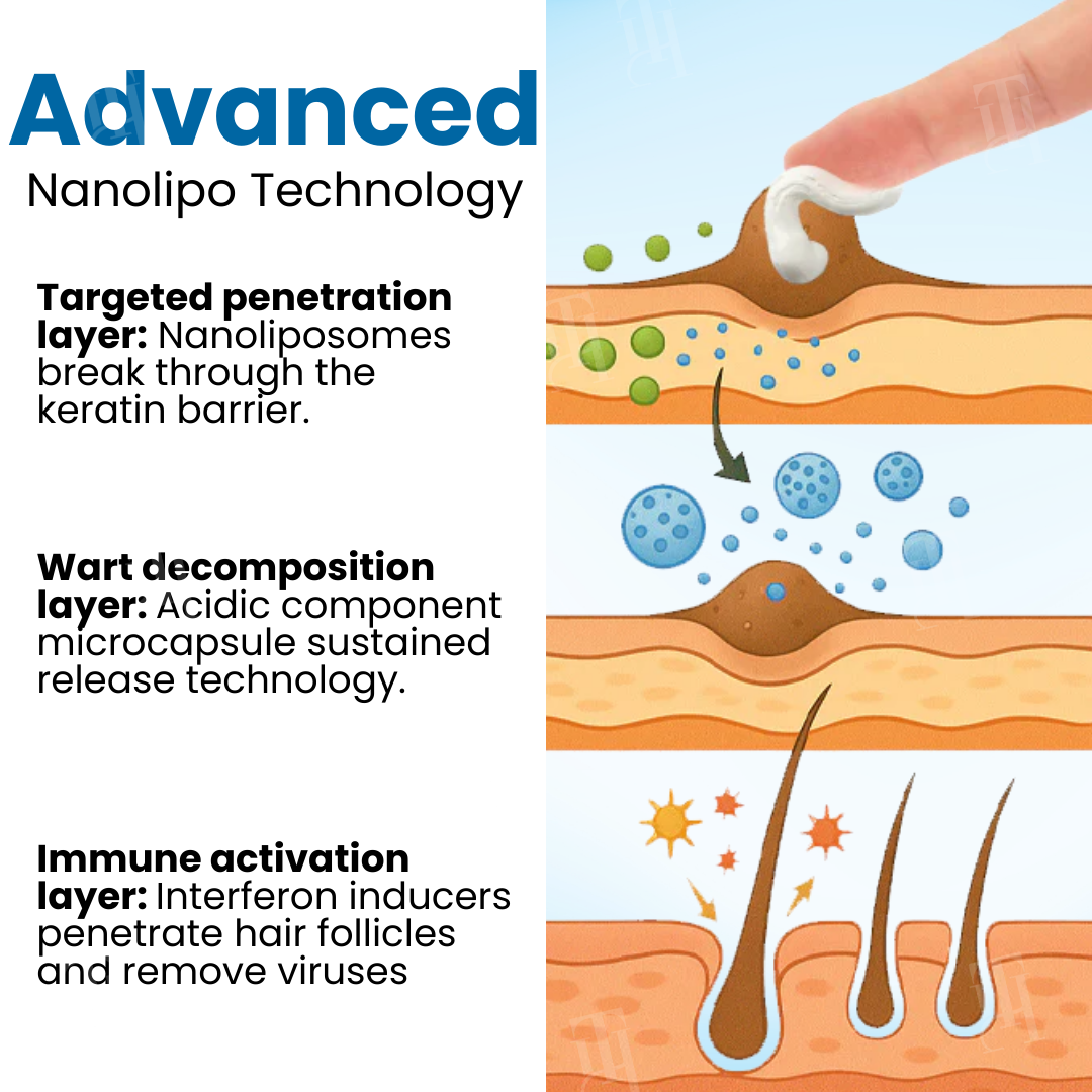 Croaie® Nanolipo Genital Warts Relief CreamðððšðŠð©ð¥ððð ððð§ð¢ððð¥ ððð¬ððšð«ððð¢ðšð§ ð¢ð§ ðð ððð²ð¬ð