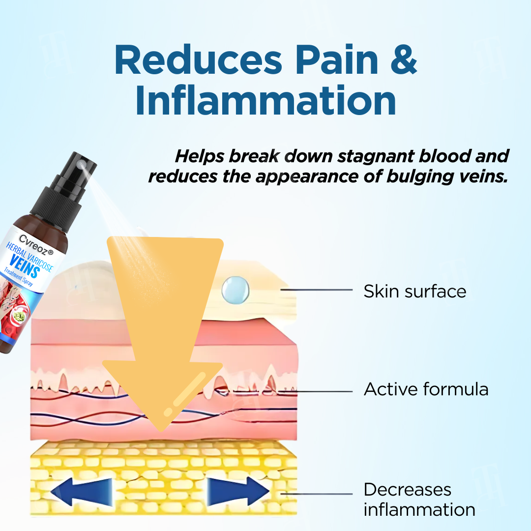 Cvreoz® Herbal Varicose Veins Treatment Spray ✅ Clinically proven to eliminate varicose veins in just 7 days!