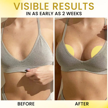 🏷️ EXCLUSIVE DEAL! 68% OFF - AEXZR® Apex-Lift Volumizing & Lifting Microneedle Bust Patch