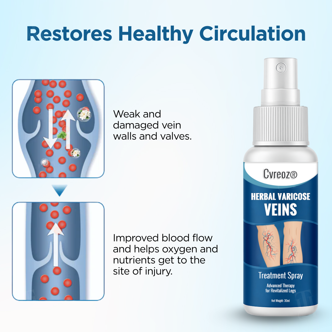 Cvreoz® Herbal Varicose Veins Treatment Spray