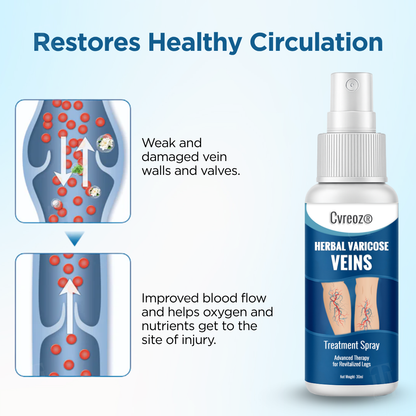Cvreoz® Herbal Varicose Veins Treatment Spray