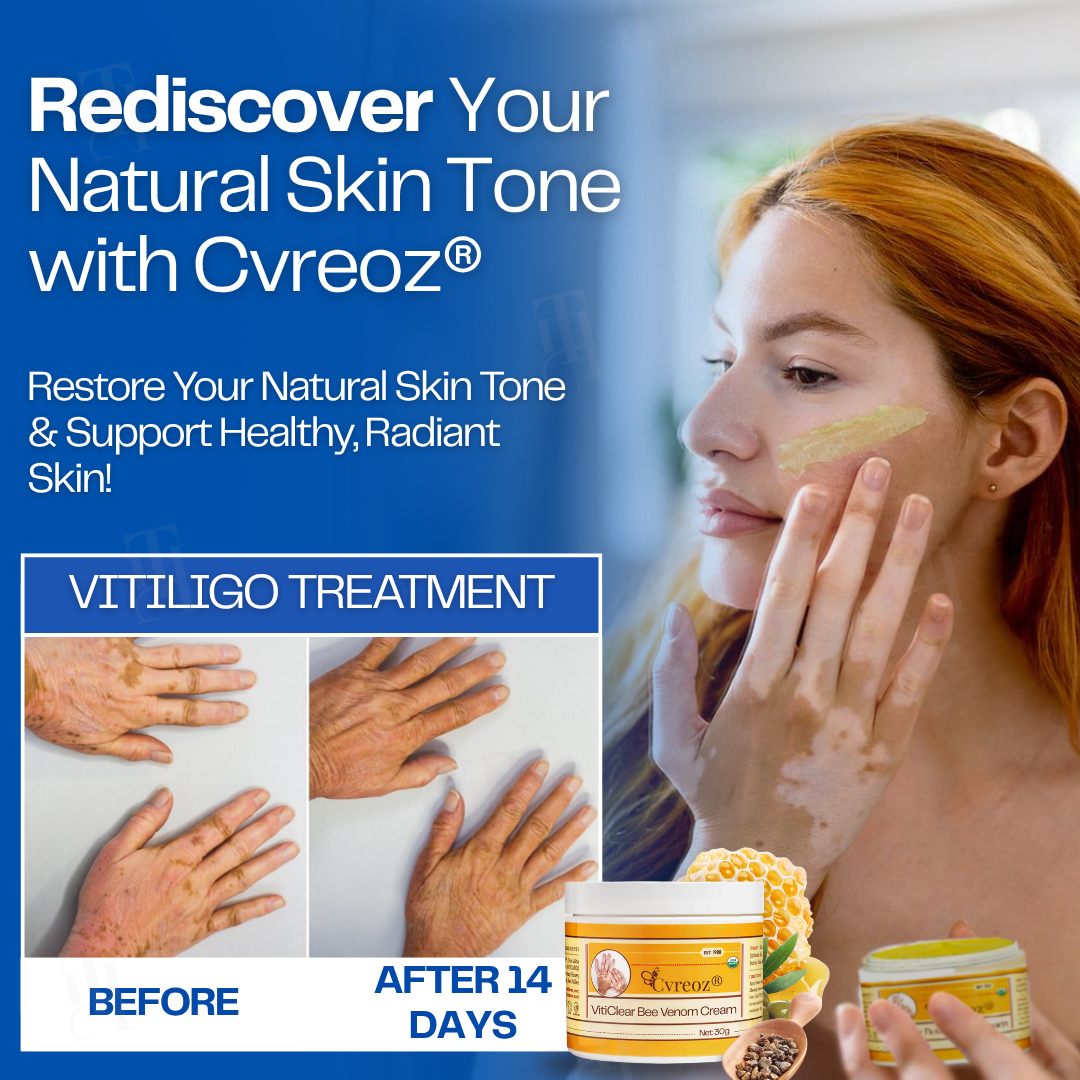 Cvreoz® VitiClear Bee Venom Cream