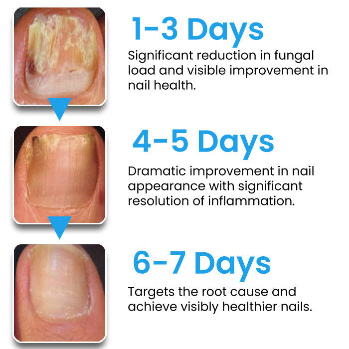 🏷️ EXCLUSIVE DEAL! 50% OFF - AEXZR® NanoFix Nail Repair Pen