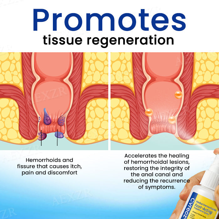 Cvreoz® Herbal Hemorrhoids Fast-Acting Treatment Spray