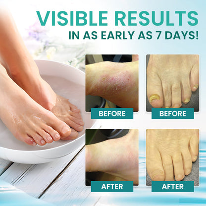 🏷️ EXCLUSIVE DEAL! 50% OFF - AEXZR® ItchBreak Sea Salt Soak