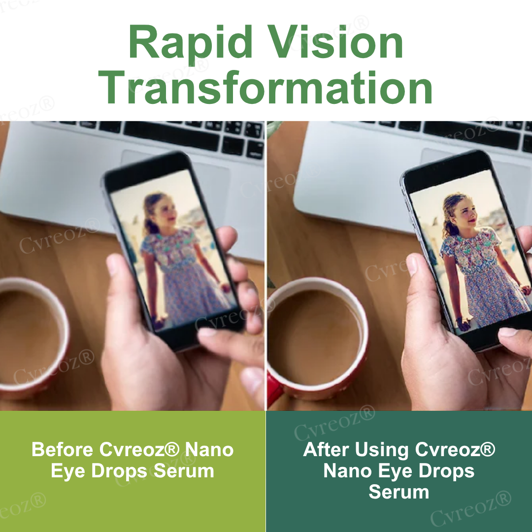 Cvreoz® Nano Eye Drops Serum