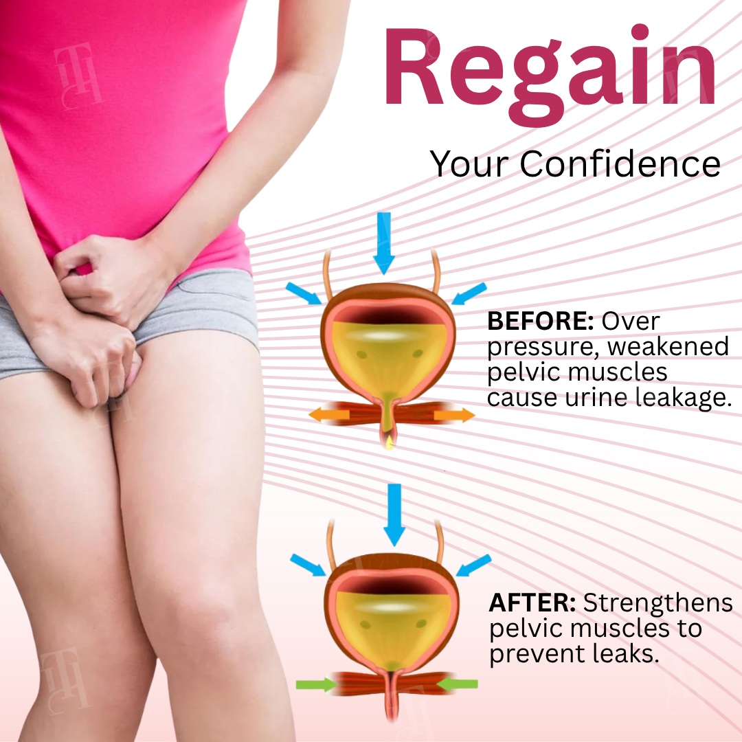 Piguiay® Bladder Control Gel✨𝐑𝐚𝐩𝐢𝐝 𝐫𝐞𝐥𝐢𝐞𝐟 𝐢𝐧 𝟏𝟒 𝐝𝐚𝐲𝐬✨