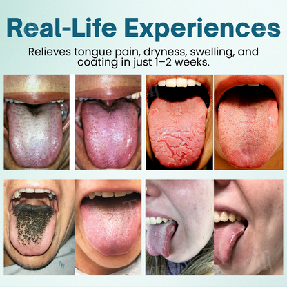 Piguiay® ProShield Tongue Restore Spray✅ 𝐏𝐫𝐨𝐯𝐢𝐝𝐞𝐬 𝐫𝐞𝐥𝐢𝐞𝐟 𝐢𝐧 𝐣𝐮𝐬𝐭 𝟑 𝐦𝐢𝐧𝐮𝐭𝐞𝐬