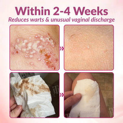 Piguiay® Femina HPV Relief Capsules ✨𝐄𝐟𝐟𝐞𝐜𝐭𝐢𝐯𝐞 𝐑𝐞𝐥𝐢𝐞𝐟 𝐟𝐫𝐨𝐦 𝐇𝐏𝐕 𝐒𝐲𝐦𝐩𝐭𝐨𝐦𝐬✨