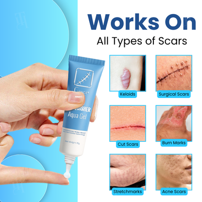 Cvreoz® Scar Vanquisher Aqua Gel