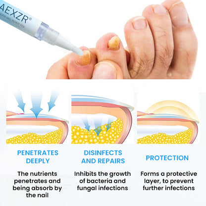 🏷️ EXCLUSIVE DEAL! 50% OFF - AEXZR® NanoFix Nail Repair Pen