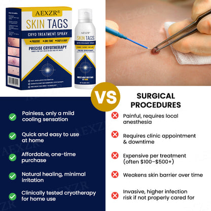 🏷️ EXCLUSIVE DEAL! 63% OFF - AEXZR® Skin Tag Cryo Treatment Spray