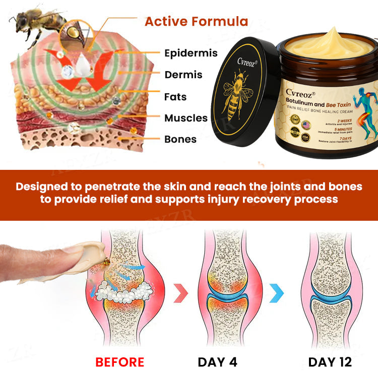 Only 10 pieces left 🚀Cvreoz® Botulinum and Bee Toxin Pain Relief Bone Healing Cream