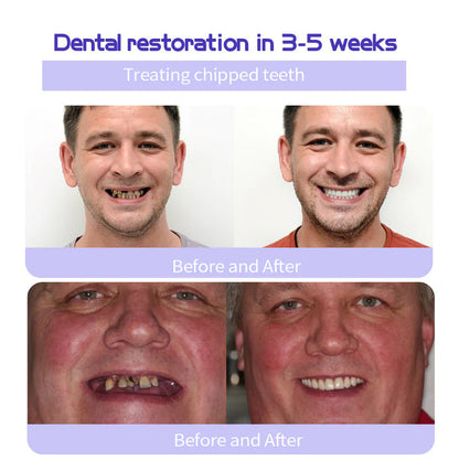 Limited Time Offer  🚨AEXZR® Teeth Restoration Mineral Powder  – Only 50 in stock available! Act Fast!