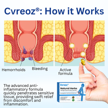 Cvreoz® Natural Herbs Strength Hemorrhoids Capsules