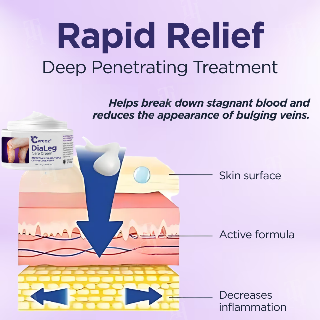 🦵 Say goodbye to varicose veins!🦵Cvreoz® DiaLeg Care Cream