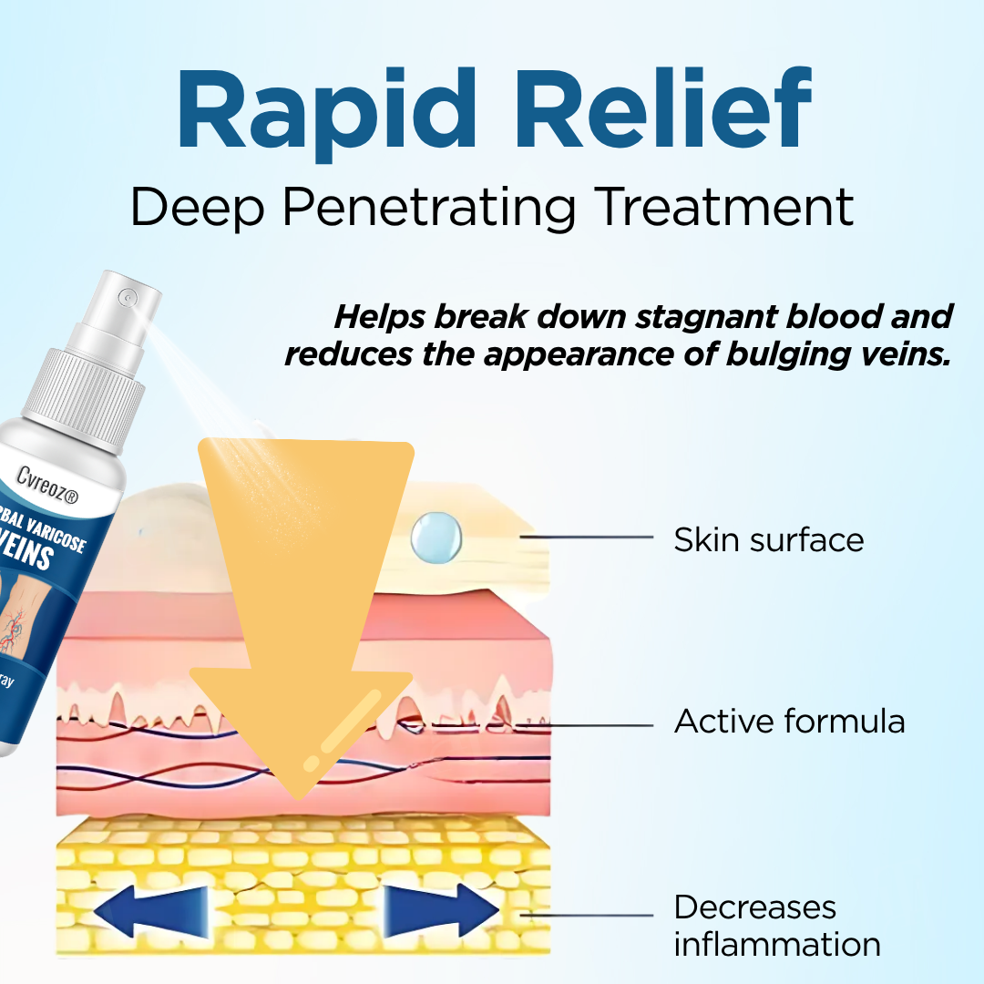 Cvreoz® Herbal Varicose Veins Treatment Spray