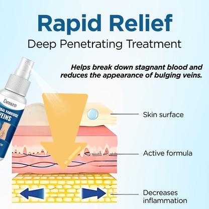 Cvreoz® Herbal Varicose Veins Treatment Spray