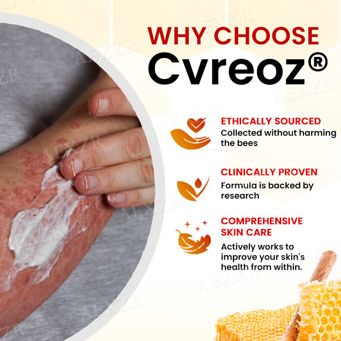 Cvreoz® Bee Venom Psoriasis Treatment Cream