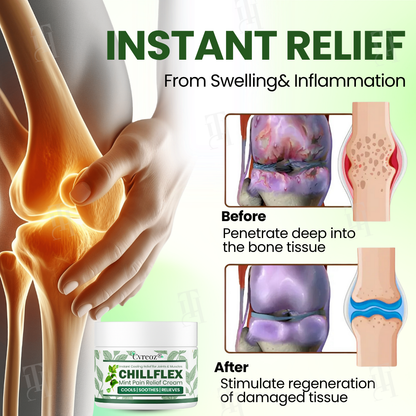 Only 10 pieces left 🚀Cvreoz® Chillflex Mint Pain Relief Cream