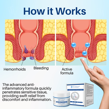 Cvreoz® Hemorrhoid & Fissure Cream✨𝟑𝟎-𝐌𝐢𝐧𝐮𝐭𝐞 𝐏𝐚𝐢𝐧 𝐑𝐞𝐥𝐢𝐞𝐟✨