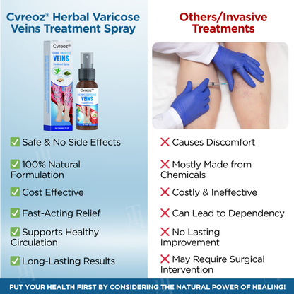 Cvreoz® Herbal Varicose Veins Treatment Spray ✅ Clinically proven to eliminate varicose veins in just 7 days!