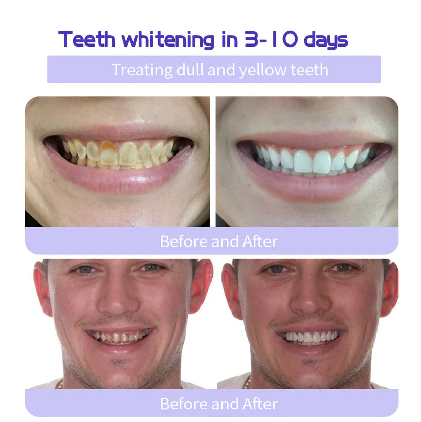 Limited Time Offer  🚨AEXZR® Teeth Restoration Mineral Powder  – Only 50 in stock available! Act Fast!