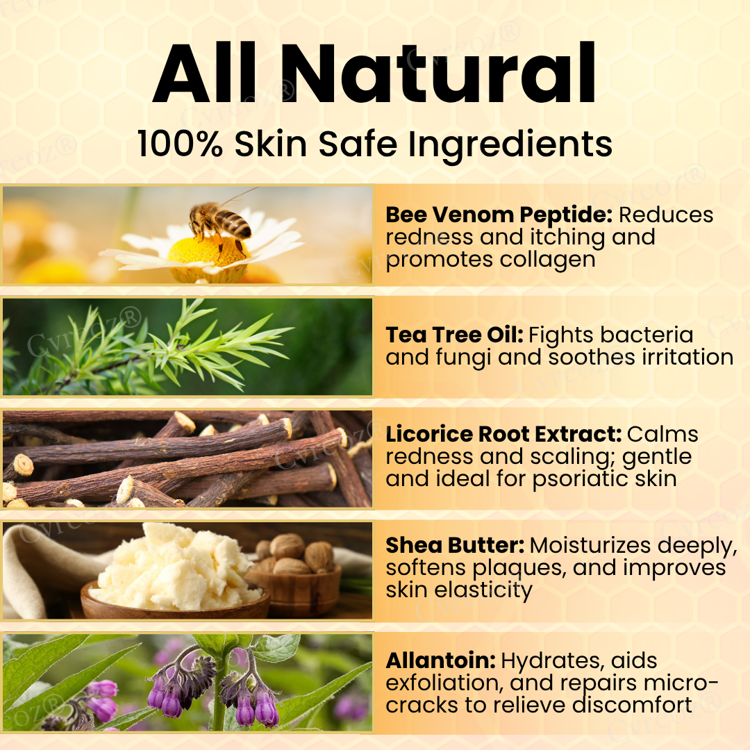 Cvreoz® Bee Venom Psoriasis Cream