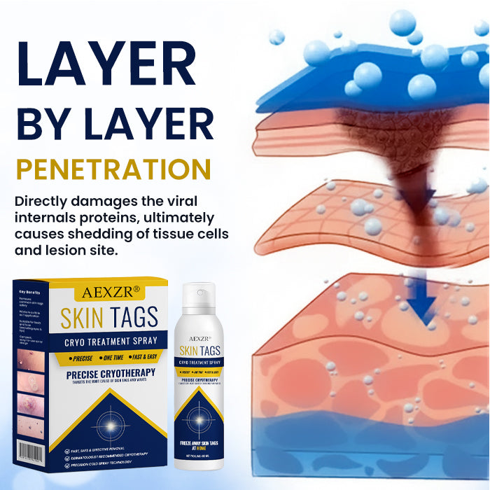 🏷️ EXCLUSIVE DEAL! 63% OFF - AEXZR® Skin Tag Cryo Treatment Spray