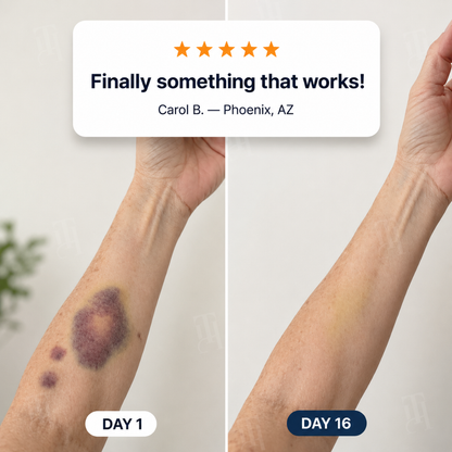 AEXZR® Bruise Repair + SPF 30 Skin-Strengthening Cream