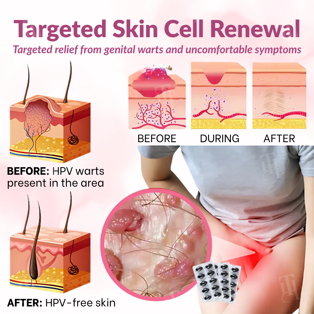 Piguiay® Femina HPV Relief Capsules ✨𝐄𝐟𝐟𝐞𝐜𝐭𝐢𝐯𝐞 𝐑𝐞𝐥𝐢𝐞𝐟 𝐟𝐫𝐨𝐦 𝐇𝐏𝐕 𝐒𝐲𝐦𝐩𝐭𝐨𝐦𝐬✨