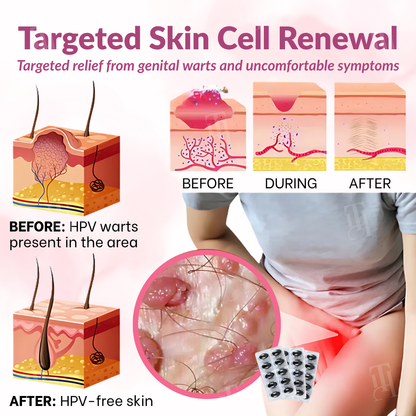 Piguiay® Femina HPV Relief Capsules ✨𝐄𝐟𝐟𝐞𝐜𝐭𝐢𝐯𝐞 𝐑𝐞𝐥𝐢𝐞𝐟 𝐟𝐫𝐨𝐦 𝐇𝐏𝐕 𝐒𝐲𝐦𝐩𝐭𝐨𝐦𝐬✨