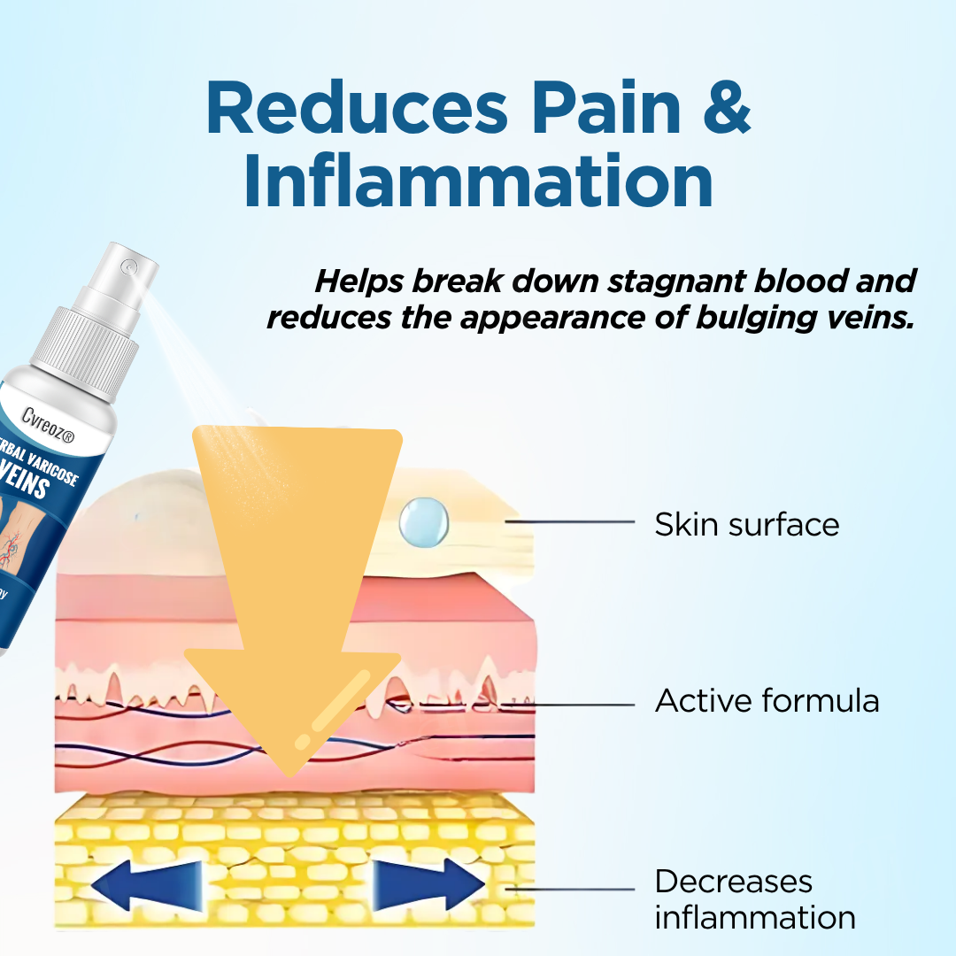 Cvreoz® Herbal Varicose Veins Treatment Spray