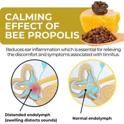 Limited Time Offer  🚨Cvreoz® Propolis Tinnitus Spray – Only 50 in stock available! Act Fast!