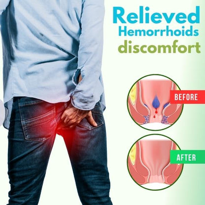 🔥Only 10 Discounts Remaining! 🔥Cvreoz® Herbal Hemorrhoid Spray