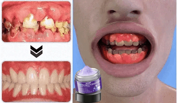 Limited Time Offer  🚨AEXZR® Teeth Restoration Mineral Powder  – Only 50 in stock available! Act Fast!