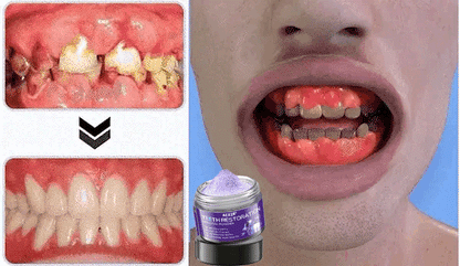 Limited Time Offer  🚨AEXZR® Teeth Restoration Mineral Powder  – Only 50 in stock available! Act Fast!